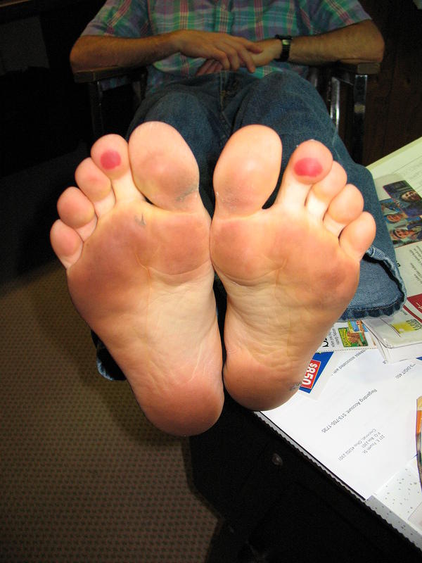 Alan feet weren't used to the sand, he ran on the beach for an hour