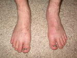 Slighlty swollen feet